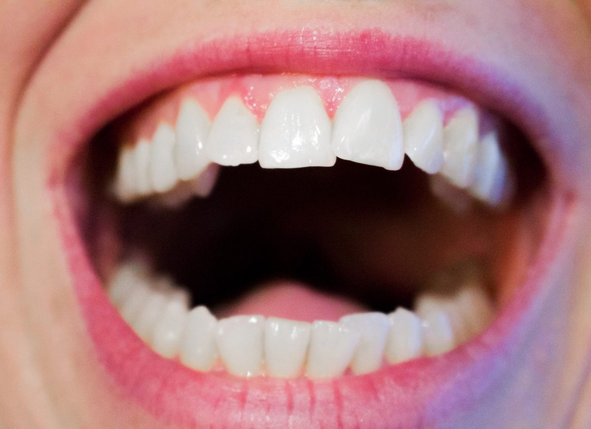 Obecna technika stosowana w salonach stomatologii estetycznej zdoła spowodować, że odbierzemy ładny uśmiech.